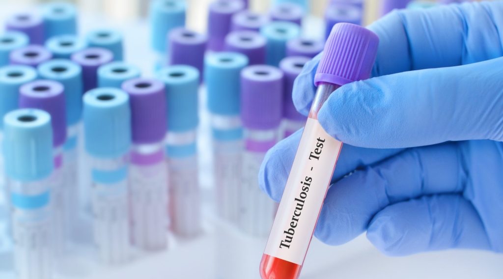 MDR-TB Treatment